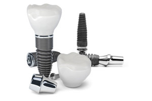 Dental Implants Jenson Dental Brigham City Conventional Implants