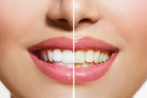 How a Cosmetic Dentist Will Restore Your Confidence