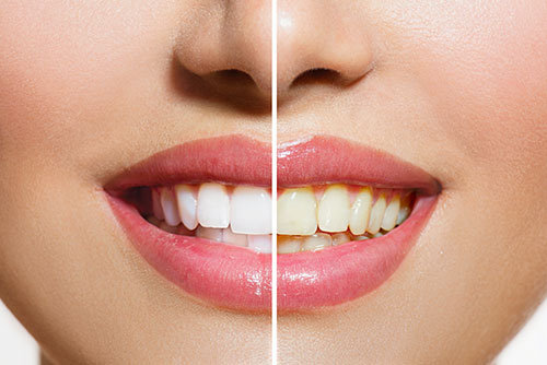 cosmetic dentist will restore confidence