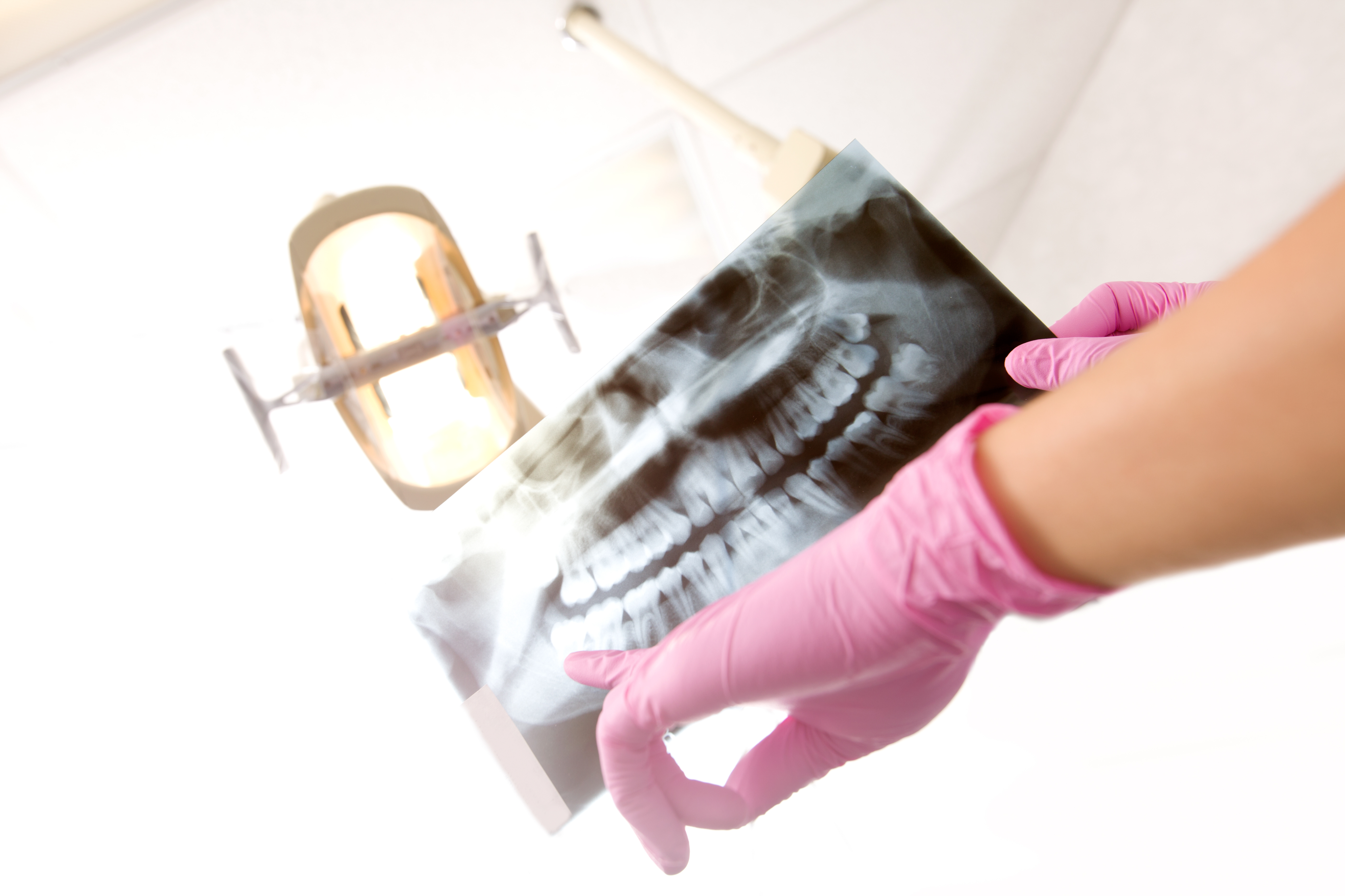 Cone Beam X Ray Jenson Dental Brigham City Utah