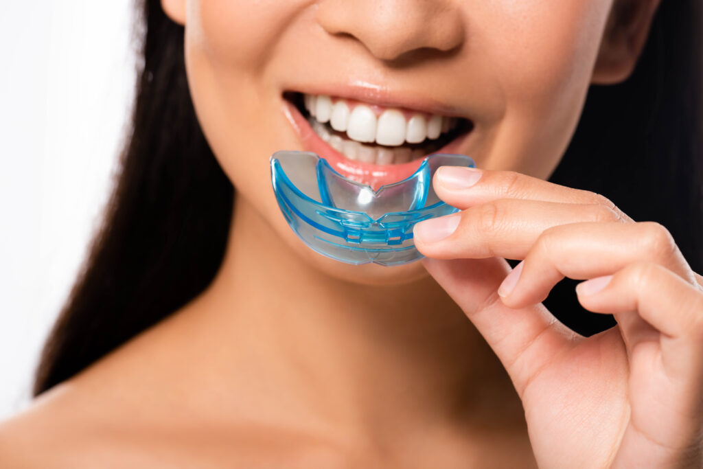 Bruxism: Answers to 6 Important Questions About Tooth Grinding